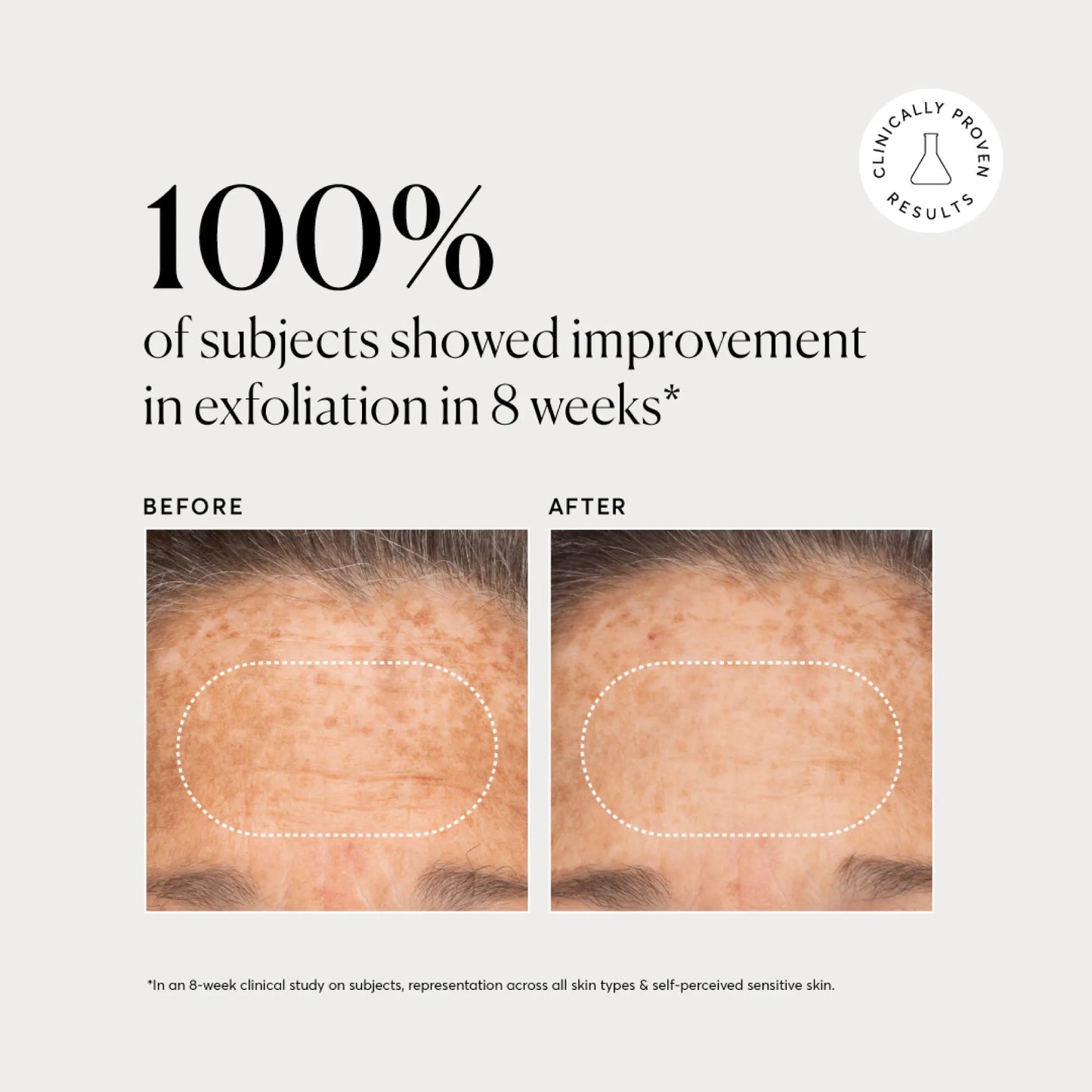 bha-liquid-exfoliant-2-x9 NATR-10027-Alt-Images-BHA-Liquid-Exfoliant-2_-03.webp