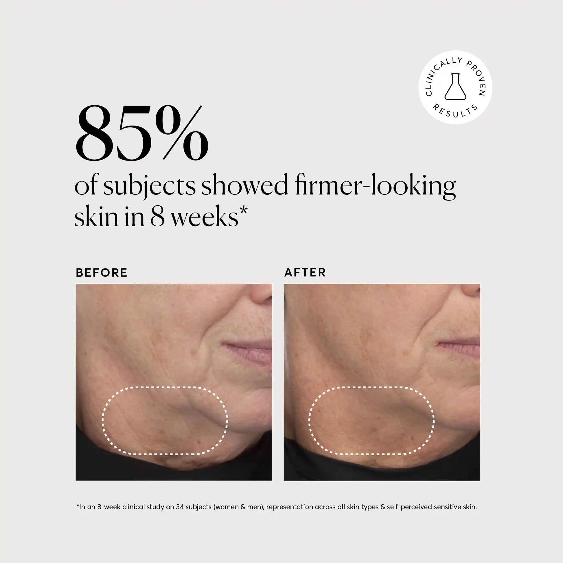 retinol-complex-serum-n3 NATR-10034-Alt-Images-Retinol-Complex-Serum-04.webp